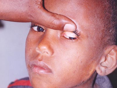 Child being screened